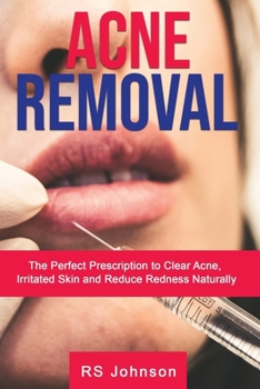 Paperback Acne Removal: The Perfect Prescription to clear Acne, Irritated skin and reduce redness naturally Book