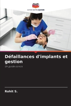 Paperback Défaillances d'implants et gestion: Un guide concis (French Edition) [French] Book