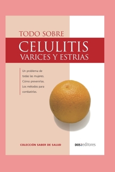 Paperback Todo Sobre Celulitis: várices y estrías [Spanish] Book