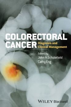 Hardcover Colorectal Cancer: Diagnosis and Clinical Management Book