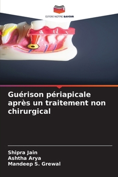 Paperback Guérison périapicale après un traitement non chirurgical [French] Book