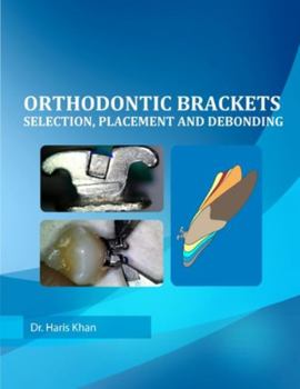 Paperback Orthodontic Brackets: Selection, Placement and Debonding Book