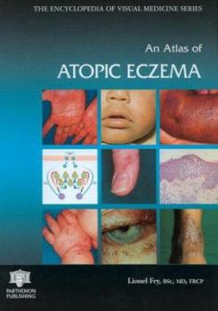 Hardcover An Atlas of Atopic Eczema Book