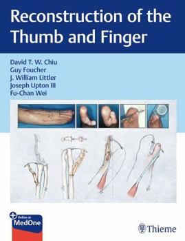 An Atlas of Digit Reconstruction: The Ray and Cascade Principle