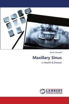 Paperback Maxillary Sinus Book