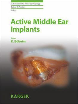 Hardcover Active Middle Ear Implants Book