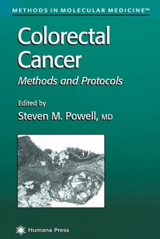 Paperback Colorectal Cancer: Methods and Protocols Book
