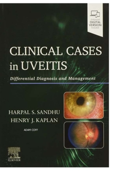 Paperback Clinical Cases in Uveitis Book