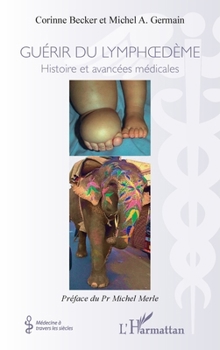 Guérir du lymphoedème: Histoires et avancées médicales (Médecine À Travers Les Siècles) (French Edition)