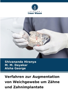 Paperback Verfahren zur Augmentation von Weichgewebe um Zähne und Zahnimplantate [German] Book