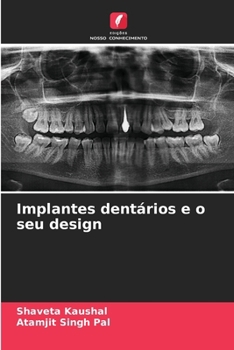 Implantes dentários e o seu design (Portuguese Edition)