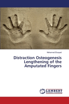 Paperback Distraction Osteogenesis Lengthening of the Amputated Fingers Book