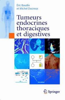 Paperback Tumeurs endocrines thoraciques et digestives (French Edition) [French] Book