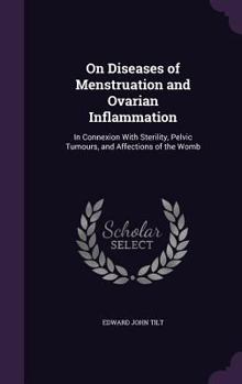 On Diseases of Menstruation and Ovarian Inflammation: In Connexion with Sterility, Pelvic Tumours, and Affections of the Womb
