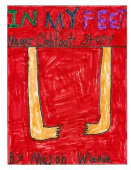 Paperback In My Feet: Mason's Clubfoot Story Book