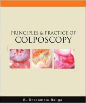 Paperback Principles and Practice of Colposcopy Book