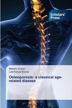 Paperback Osteoporosis: a classical age-related disease Book