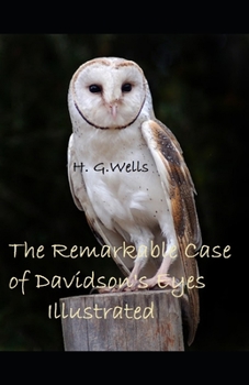 The Remarkable Case of Davidson's Eyes Illustrated