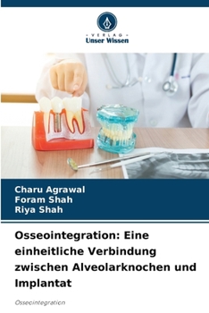 Paperback Osseointegration: Eine einheitliche Verbindung zwischen Alveolarknochen und Implantat [German] Book