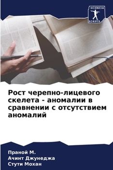 Paperback Рост черепно-лицевого ск [Russian] Book