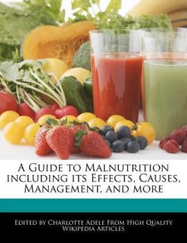 Paperback A Guide to Malnutrition Including Its Effects, Causes, Management, and More Book