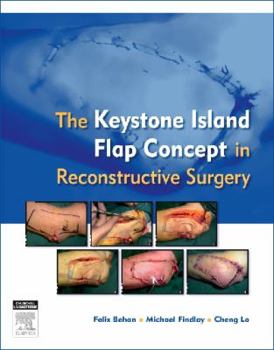 Paperback The Keystone Island Flap Concept in Reconstructive Surgery Book