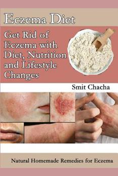 Eczema Diet - Get Rid of Eczema with Diet, Nutrition and Lifestyle Changes: Natural Homemade Remedies for Eczema