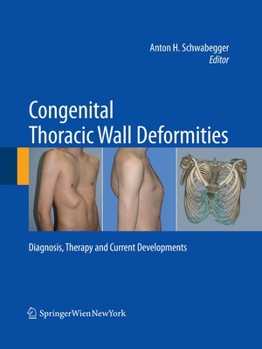 Paperback Congenital Thoracic Wall Deformities: Diagnosis, Therapy and Current Developments Book