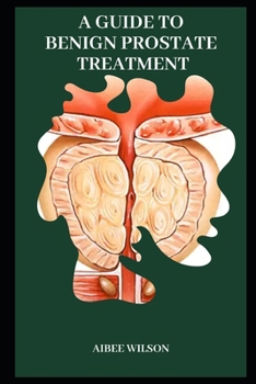 Paperback A Guide to Benign Prostate Treatment Book