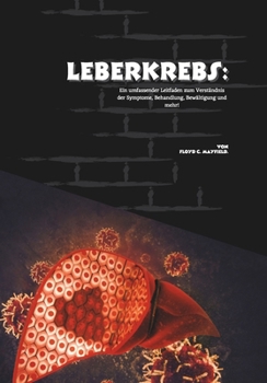 Leberkrebs: Ein umfassender Leitfaden zum Verständnis der Symptome, Behandlung, Bewältigung und mehr! (German Edition)
