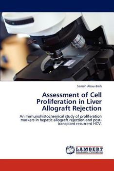 Paperback Assessment of Cell Proliferation in Liver Allograft Rejection Book