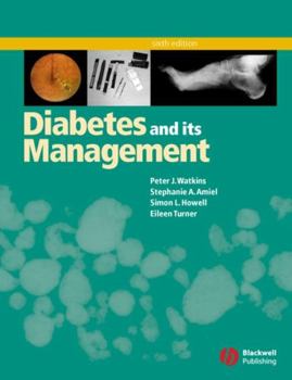 Paperback Diabetes and Its Management Book