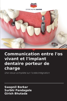 Paperback Communication entre l'os vivant et l'implant dentaire porteur de charge [French] Book