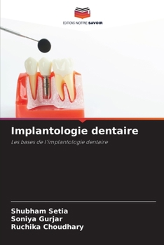 Paperback Implantologie dentaire [French] Book