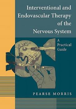 Paperback Interventional and Endovascular Therapy of the Nervous System: A Practical Guide Book