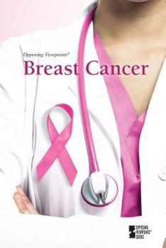 Breast Cancer - Book  of the Opposing Viewpoints