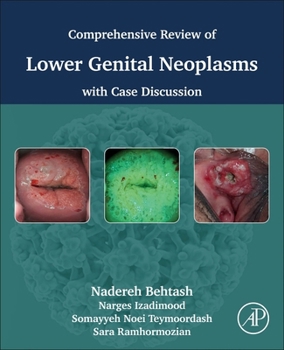 Paperback Comprehensive Review of Lower Genital Neoplasms: With Case Discussion Book