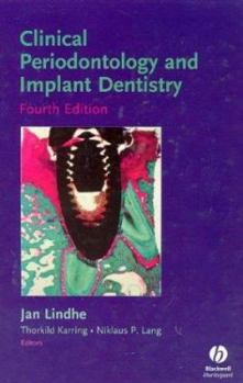 Hardcover Clinical Periodontology and Implant Dentistry Book