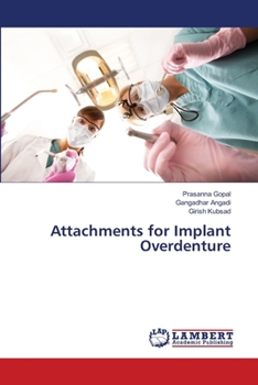 Paperback Attachments for Implant Overdenture Book
