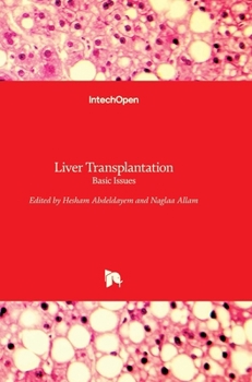 Hardcover Liver Transplantation: Basic Issues Book