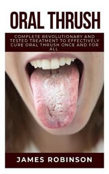 Paperback Oral Thrush: Complete Revolutionary and Tested Treatment to Effectively Cure Oral Thrush Once and For All Book