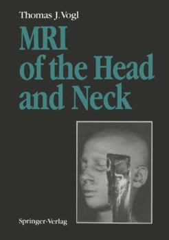 Paperback MRI of the Head and Neck: Functional Anatomy -- Clinical Findings -- Pathology -- Imaging Book