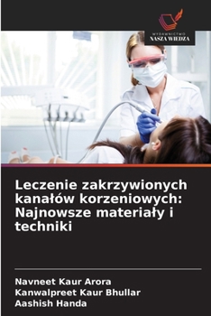 Leczenie zakrzywionych kanalów korzeniowych: Najnowsze materialy i techniki (Polish Edition)
