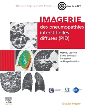 Paperback Imagerie Des Pneumopathies Interstitielles Diffuses (Pid) [French] Book