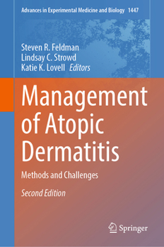 Hardcover Management of Atopic Dermatitis: Methods and Challenges Book