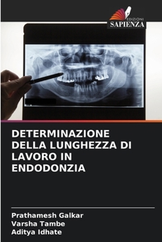 Paperback Determinazione Della Lunghezza Di Lavoro in Endodonzia [Italian] Book