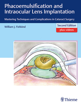 Hardcover Phacoemulsification and Intraocular Lens Implantation: Mastering Techniques and Complications in Cataract Surgery Book