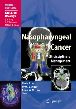 Paperback Nasopharyngeal Cancer: Multidisciplinary Management Book