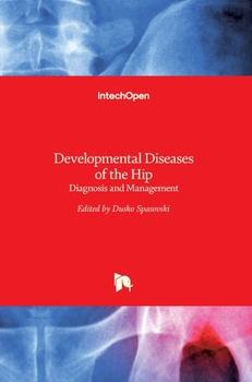 Hardcover Developmental Diseases of the Hip: Diagnosis and Management Book