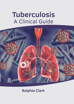 Hardcover Tuberculosis: A Clinical Guide Book